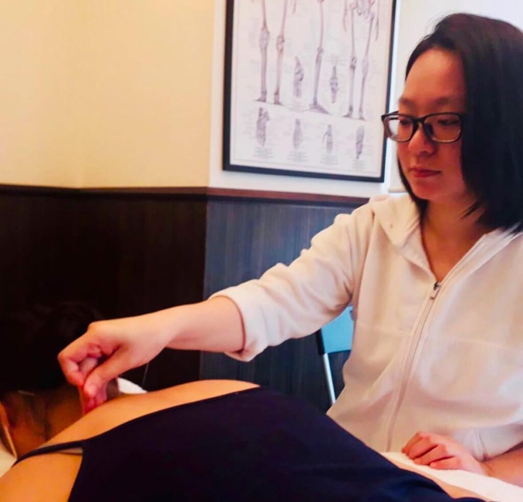 A female getting traditional Chinese medicine therapy done by Grace Yu.