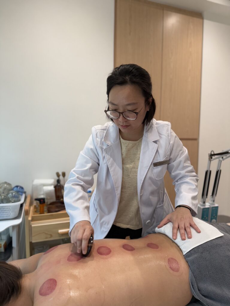 Dr. Grace Yu treating a patient with cupping therapy.
